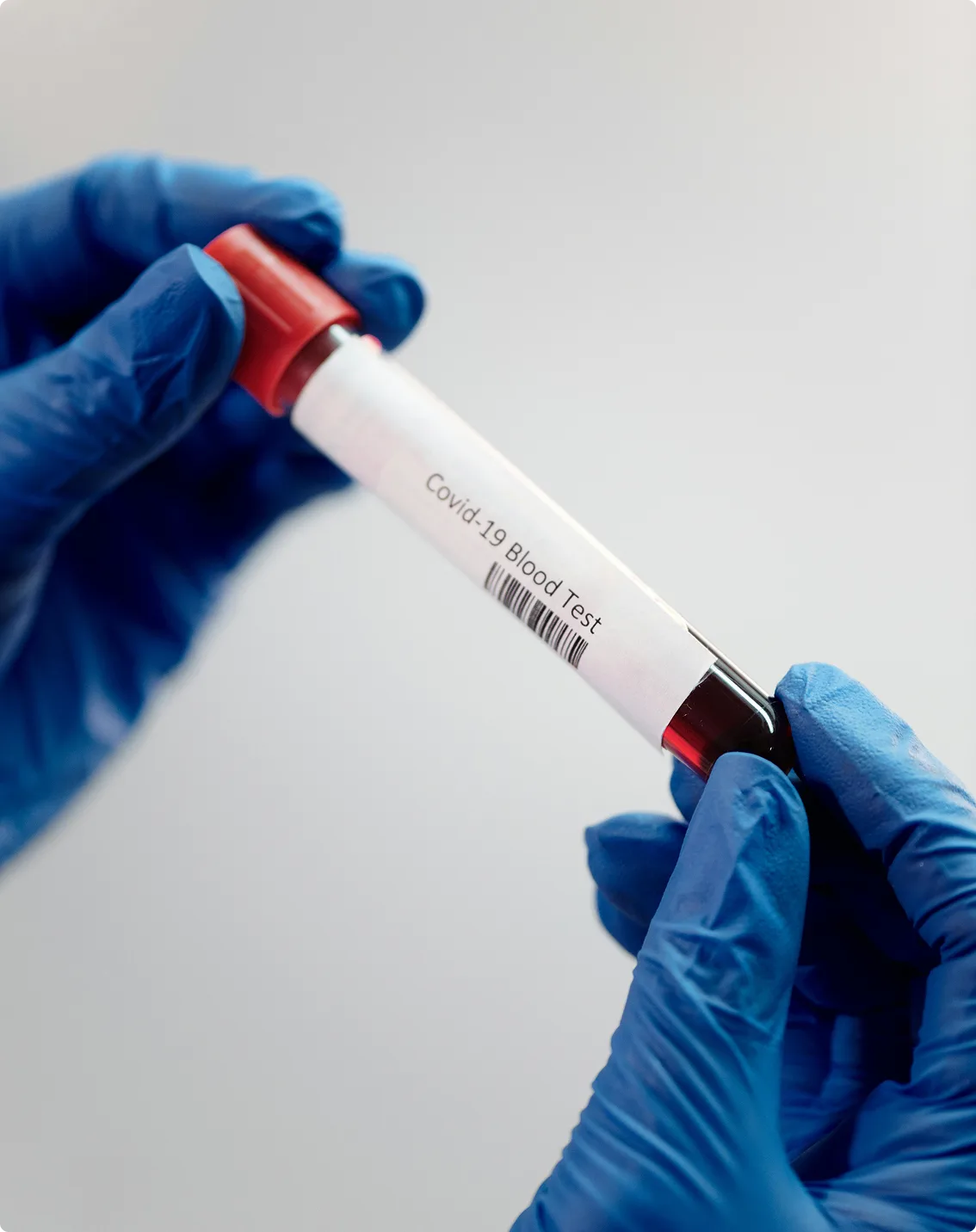 Hand in blue gloves holding a blood sample tube